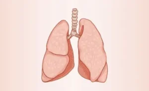 Lung Transplant cost in India