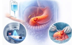 Pancreatic Cancer Treatment Cost in India